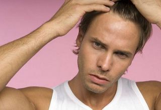 почему у мужчин выпадают волосы