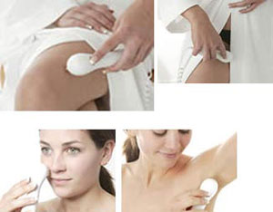 Удаление волос лазером