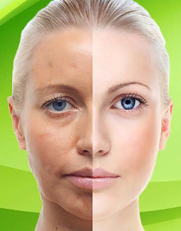 Отбеливающие маски от пигментных пятен фото