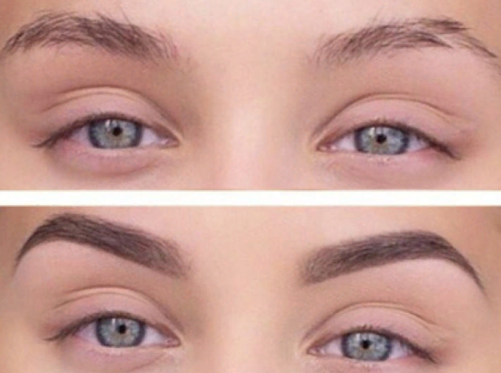 отзывы на микроблейдинг бровей фото