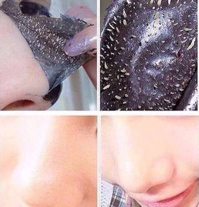 пленочная маска от черных точек на лице фото