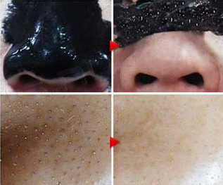 эффективные маски от черных точек фото