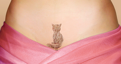 Интимно об интимной эпиляции