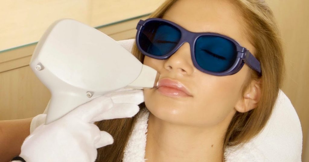 Эпиляция губы: делать или нет?