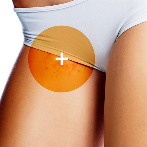 Почему после эпиляции появляются вросшие волоски и как с ними бороться