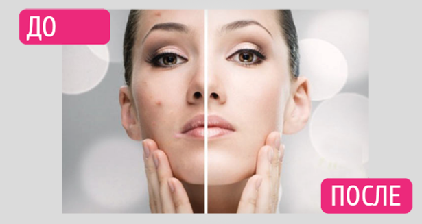 Что нужно знать о вакуумной чистке лица вакуумной чистке лица