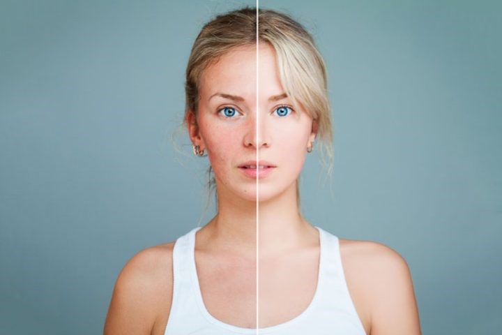 5 ошибок, которые мы совершаем при использовании маски-пилинга эффект пилинга