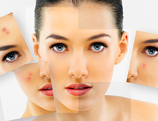 Чистка лица: процедура, необходимая каждой женщине