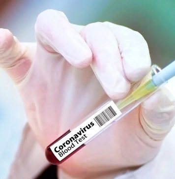 Более 20 тысяч волонтеров согласились заразиться схожими с COVID-19 вирусами за 4,4 тысячи долларов