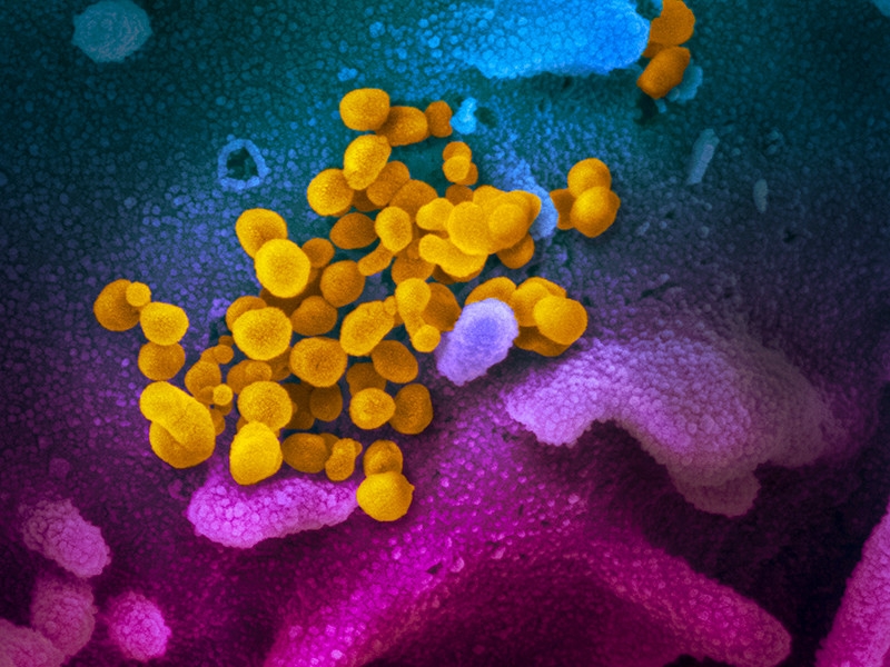 Итальянские врачи назвали болезни, повышающие риск умереть при коронавирусе