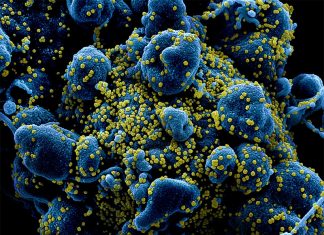 Назван еще один возможный признак коронавируса — конъюнктивит