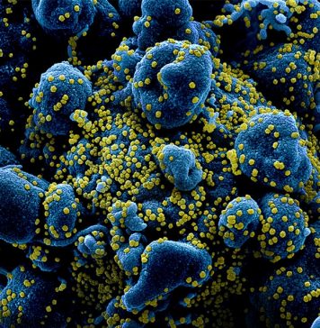 Назван еще один возможный признак коронавируса — конъюнктивит