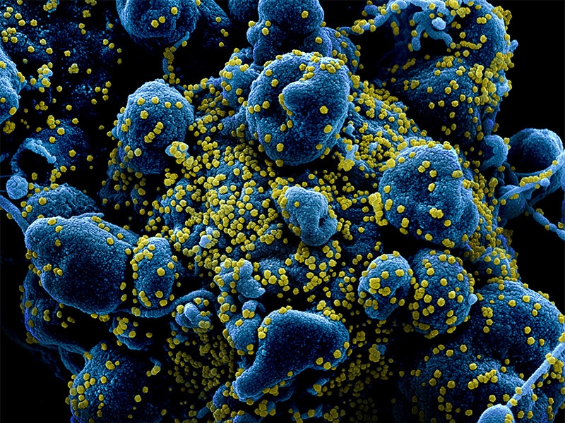 Назван еще один возможный признак коронавируса - конъюнктивит