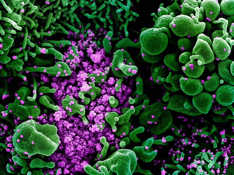 Прогноз МВД ФРГ: при самом позитивном сценарии в Германии заразятся коронавирусом около 1 млн человек