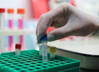 Ученые Роспотребнадзора создали высокоточный тест для диагностики коронавируса