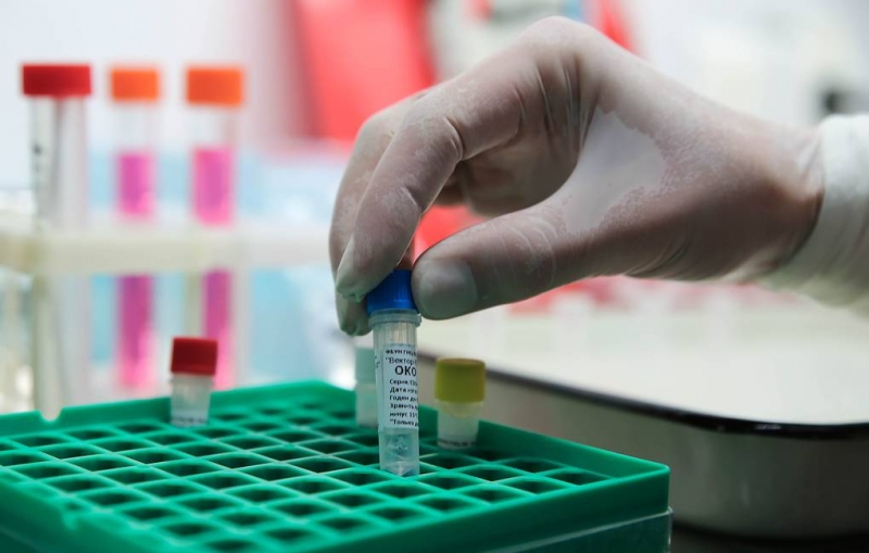 Ученые Роспотребнадзора создали высокоточный тест для диагностики коронавируса

