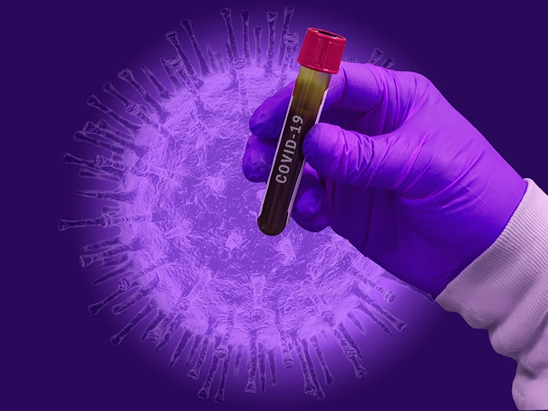 Amnesty International: в России и странах бывшего СССР вводят репрессии под предлогом борьбы с коронавирусом