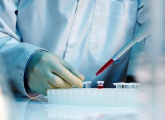 Израиль попросил Россию прислать наборы для серологических тестов на коронавирус