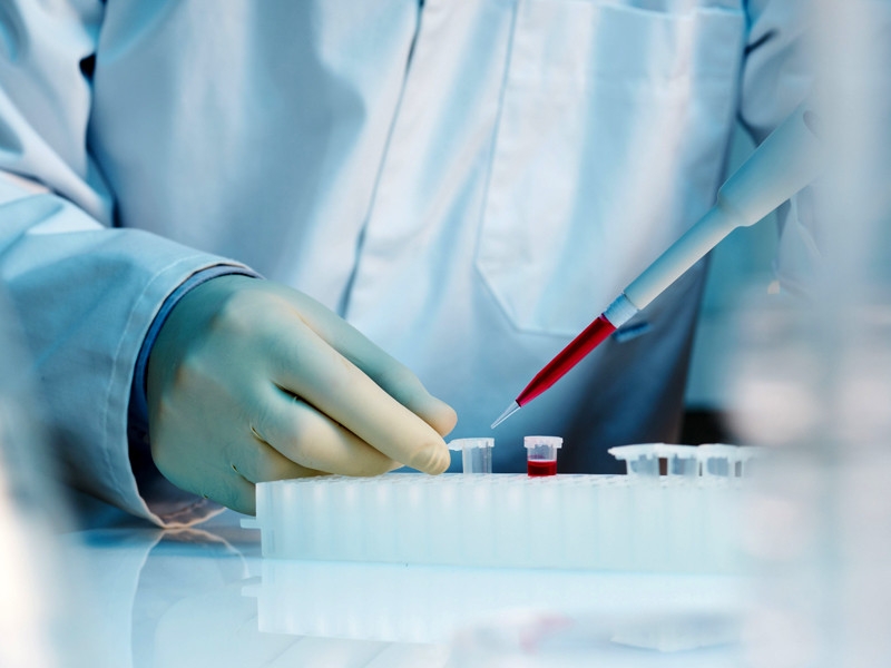 Израиль попросил Россию прислать наборы для серологических тестов на коронавирус