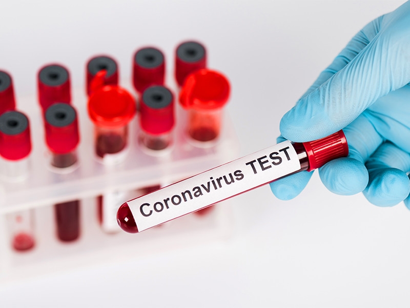 После первой волны пандемии коронавируса в мире могут ввести "иммунные паспорта" для пересечения границ