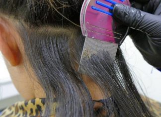 Основные способы борьбы со вшами