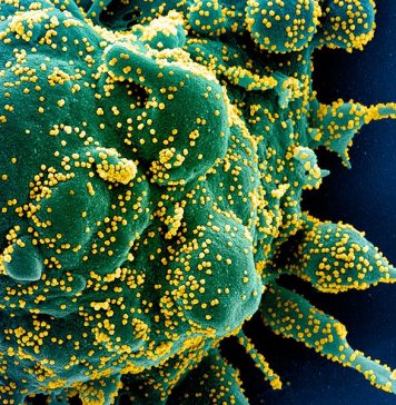 Более 60 государств поддержали предложение властей Австралии о проведении независимого расследования появления COVID-19