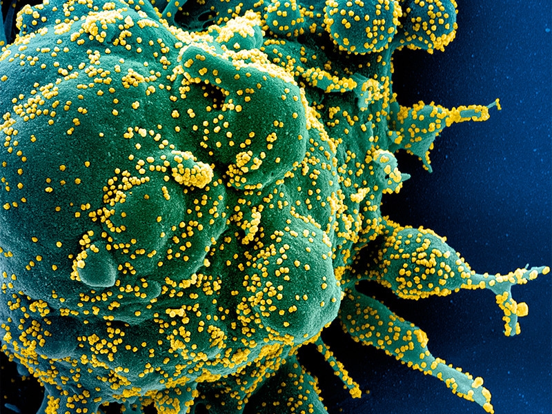 Более 60 государств поддержали предложение властей Австралии о проведении независимого расследования появления COVID-19