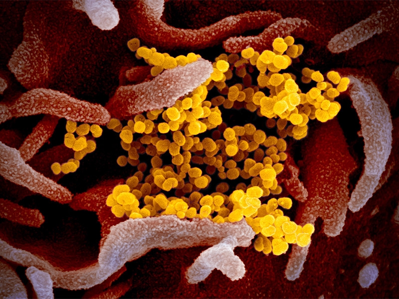 Иск не исключен: в чем конкретно США могут обвинить КНР в связи с появлением COVID-19