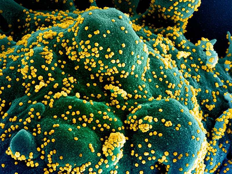 Известный китайский эпидемиолог рассказал о молчании властей Уханя о вспышке коронавируса