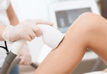 Лазерная эпиляция ног
