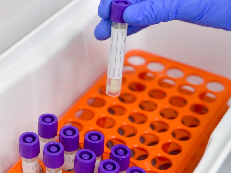 Первые зараженные COVID-19 появились в Европе еще в декабре. ВОЗ призвала страны проверить декабрьские анализы пациентов с пневмонией