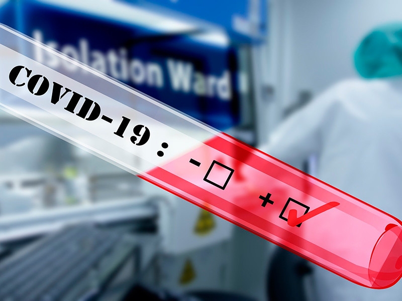 В Европе опасаются, что пандемия коронавируса может подать террористам идею об использовании биологического оружия