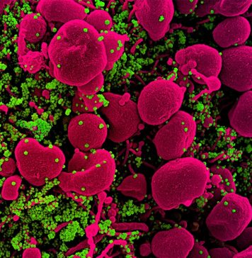 Число умерших от COVID-19 в мире превысило 400 тыс.