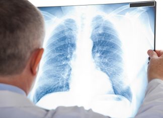 Посольство КНР в Казахстане объявило о новом смертельном виде пневмонии, Минздрав отрицает эту информацию