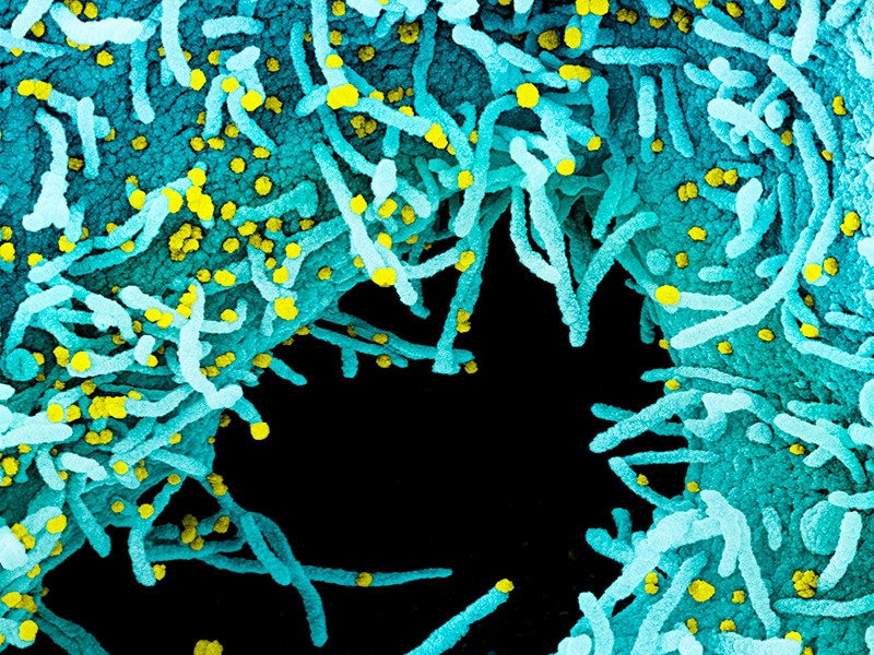 Северная Корея заявила о возможном первом случае заражения COVID-19
