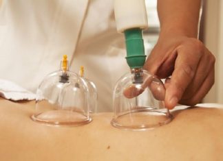 Где купить банки для массажа и хиджамы