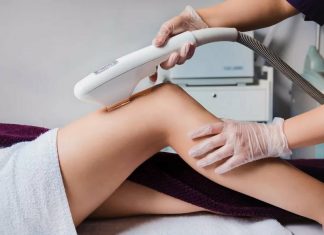 Лазерная эпиляция