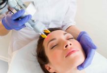 Лазерное удаление шрамов постакне