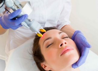 Лазерное удаление шрамов постакне