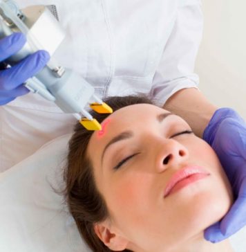 Лазерное удаление шрамов постакне