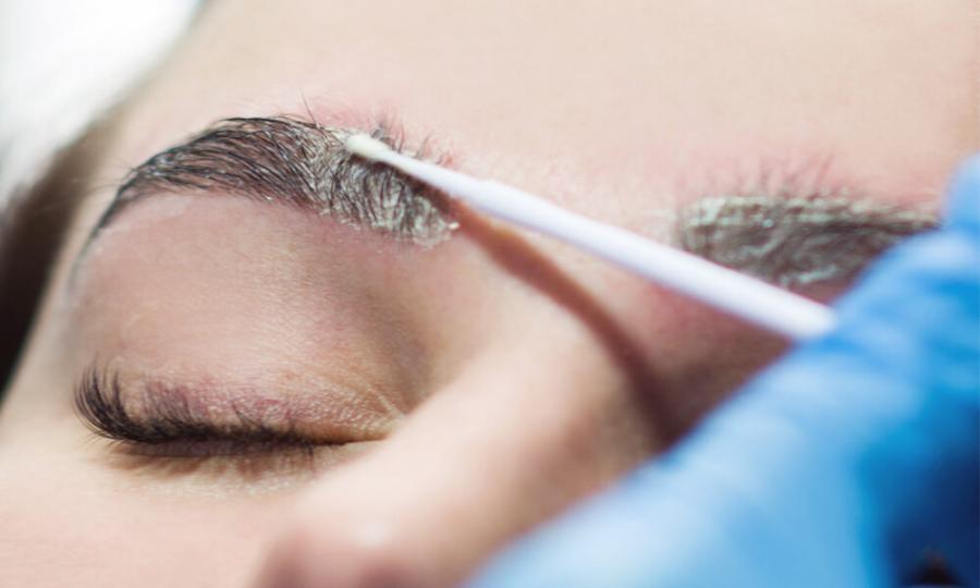 Удаление татуажа ремувером: принцип действия