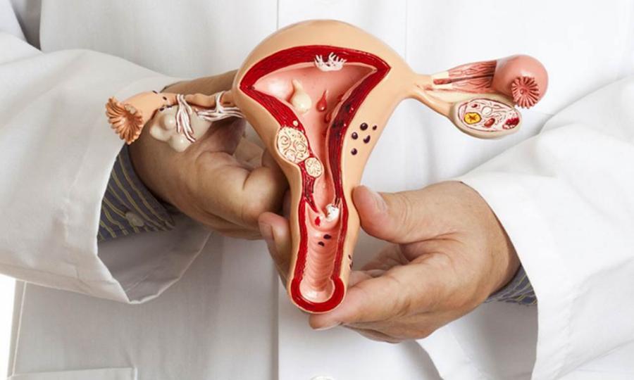 Эндометрит и эндометриоз: два диагноза – одна проблема