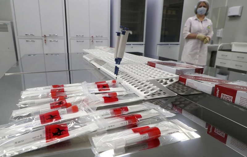 В РФ зарегистрировали первую в мире тест-систему для выявления британского штамма COVID-19
