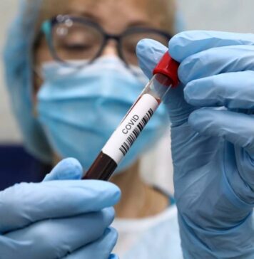 В «Векторе» заявили, что высокий уровень антител не гарантирует защиту от коронавируса