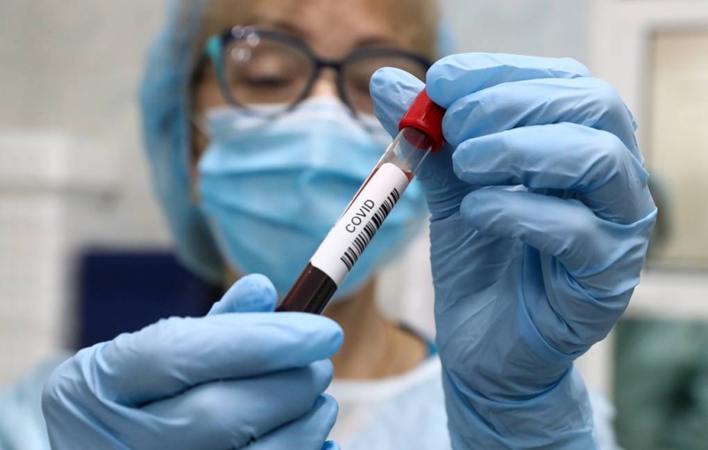 В "Векторе" заявили, что высокий уровень антител не гарантирует защиту от коронавируса

