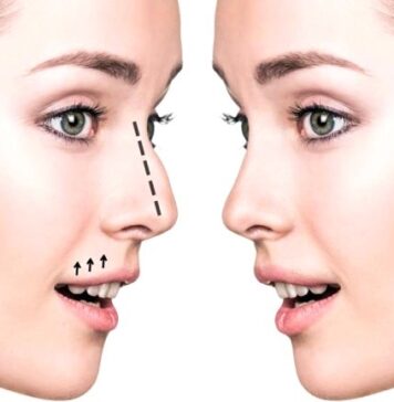 Ринопластика: показания
