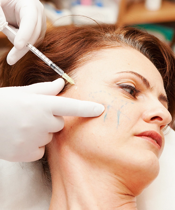 Липофилинг: безопасная альтернатива классической хирургии?