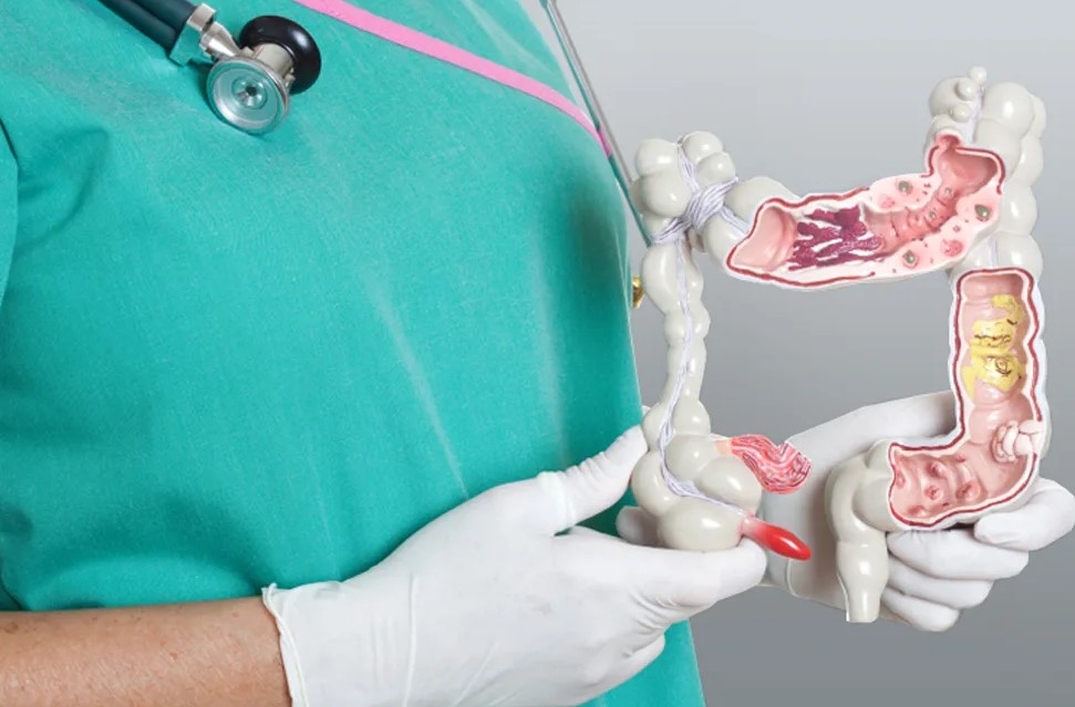Что лечит проктолог