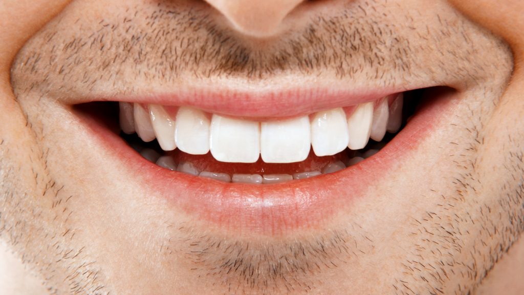 Преимущества имплантации зубов