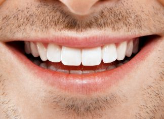 Преимущества имплантации зубов